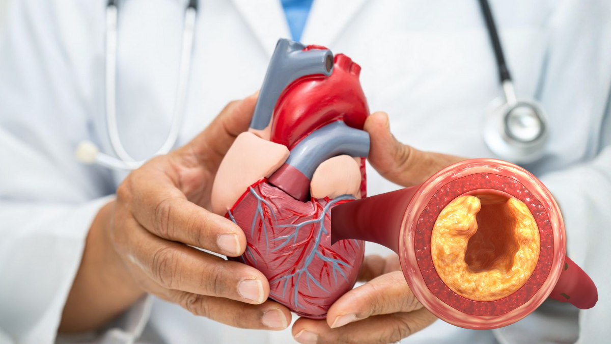 clogged hearth arteries